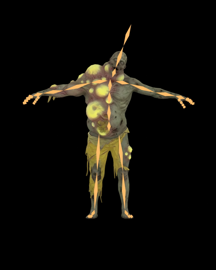 Boils skeleton